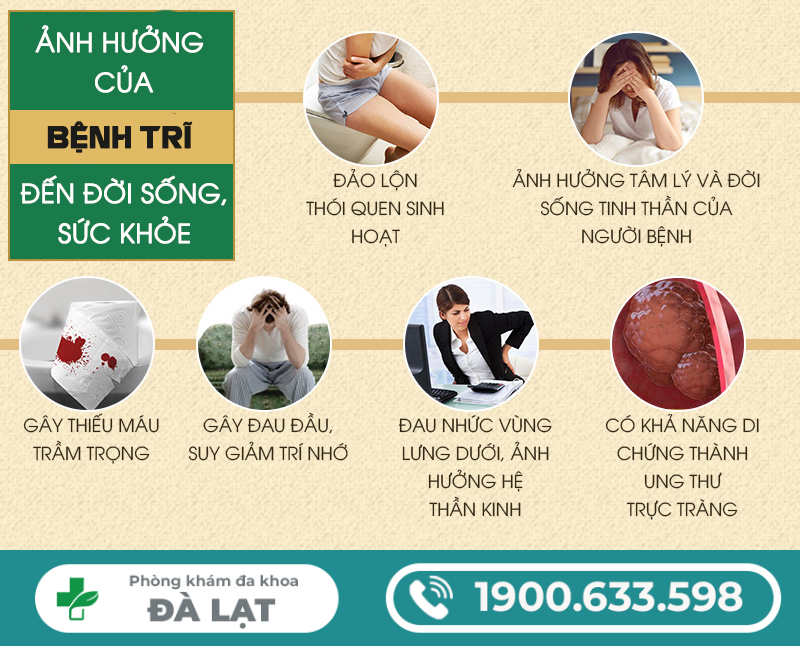 Hình ảnh minh họa